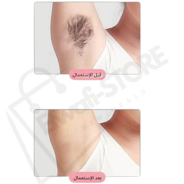 باقـــة الأنوثـــة PRO™ (All In One)